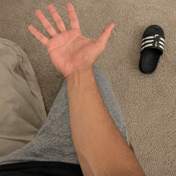 Avant-bras avant l'entraînement avec GripLab